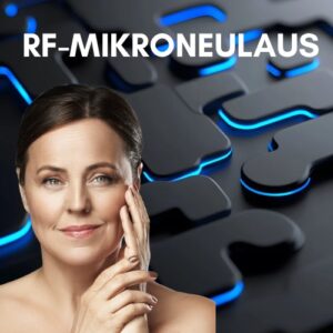 RF-mikroneulaus Kuopiossa. Kivuton ja veretön hoito yhdistää mikroneulauksen ja radiofrekvenssin